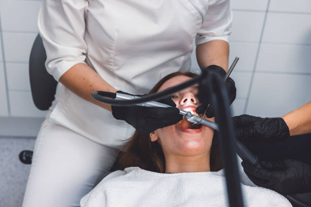 Best Emergency Wisdom Tooth Extraction in Seven Hills, OH